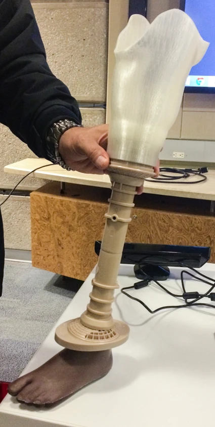 Full prosthetic leg assembly